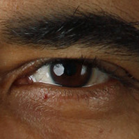 catchlighteye